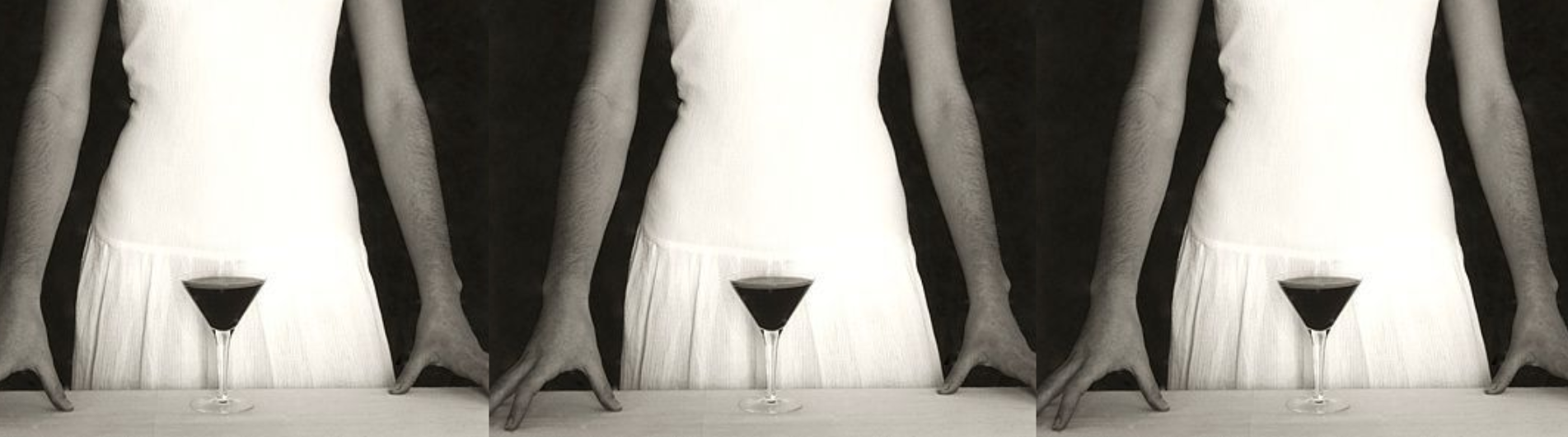 Depilação íntima: necessidade para saúde ou estética?